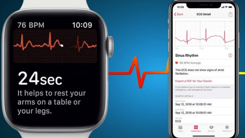 biểu đồ dữ liệu nhịp tim